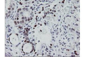 Image no. 1 for anti-Early Growth Response 2 (EGR2) (AA 156-476) antibody (ABIN1490982)