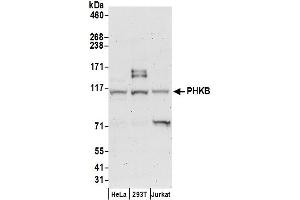 Western Blotting (WB) image for anti-Phosphorylase Kinase, beta (PHKB) (AA 650-700) antibody (ABIN7449789)