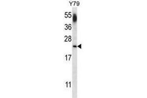 CNRP1 Antibody (Center) western blot analysis in Y79 cell line lysates (35µg/lane). (Cnrip1 antibody  (Middle Region))