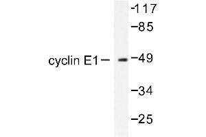 Image no. 1 for anti-Cyclin E1 (CCNE1) antibody (ABIN265379) (Cyclin E1 antibody)