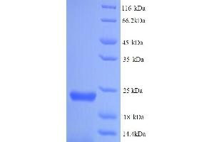 SDS-PAGE (SDS) image for Gen Endonuclease Homolog 1 (GEN1) (AA 1-183), (full length) protein (His tag) (ABIN4977055) (GEN1 Protein (AA 1-183, full length) (His tag))