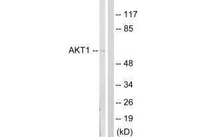 Western blot analysis of extracts from NIH/3T3cells, treated with PDGF (50 mg /mL, 20 mins), using Akt (Ab-124) antibody. (AKT1 antibody  (Ser124))