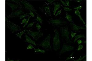 Immunofluorescence of monoclonal antibody to LRRN1 on HeLa cell. (LRRN1 antibody  (AA 1-716))