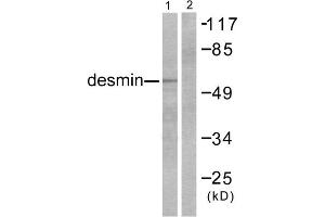 Western blot analysis of extracts from K562 cells, using Desmin antibody.