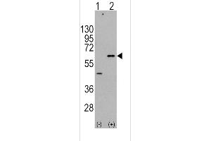 Western blot analysis of AKT3 (arrow) using rabbit polyclonal AKT3 Antibody  (ABIN391027 and ABIN2841197). (AKT3 antibody  (AA 450-479))