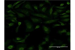 Immunofluorescence of monoclonal antibody to IL15 on HeLa cell. (IL-15 antibody  (AA 49-162))