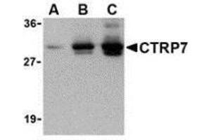 Western blot of recombinant CTRP7: (A) 5 ng, (B) 25 ng, and (C) 50 ng with AP30260PU-N CTRP2 antibody at 1 ug/ml. (CTRP7 antibody)