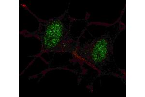 Fluorescent confocal ige of SY5Y cells stained with SD2 antibody. (SMAD2 antibody  (AA 97-125))