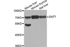 Western Blotting (WB) image for anti-Deoxynucleotidyltransferase, terminal (DNTT) antibody (ABIN1882380) (TdT antibody)