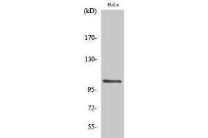 Western Blotting (WB) image for anti-Nuclear Factor of kappa Light Polypeptide Gene Enhancer in B-Cells 1 (NFKB1) (pSer927) antibody (ABIN3179730) (NFKB1 antibody  (pSer927))