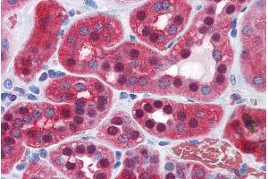 Immunohistochemistry (IHC) image for anti-Glucose-6-Phosphate Isomerase (GPI) (AA 81-93) antibody (ABIN571080)