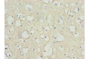 Immunohistochemistry of paraffin-embedded human brain tissue using ABIN7162977 at dilution of 1:100