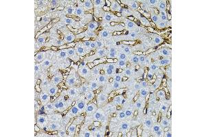 Immunohistochemistry of paraffin-embedded mouse liver using CBL antibody (ABIN5995395) (40x lens).