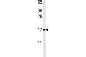 CCL4 antibody western blot analysis in mouse bladder tissue lysate (15ug/lane).