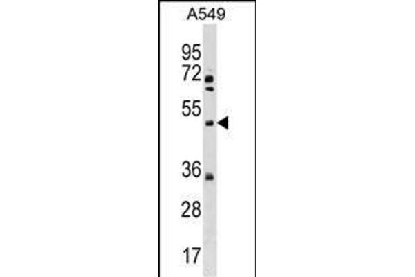 Membrane transport protein XK (XK) (AA 83-111), (N-Term) antibody