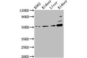 Western Blot Positive WB detected in: K562 whole cell lysate, Rat kidney tissue, Mouse liver tissue, Mouse kidney tissue All lanes: GSS antibody at 5. (Glutathione Synthetase antibody  (AA 290-418))