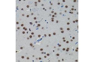 Immunohistochemistry of paraffin-embedded rat brain using SMAD5 antibody (ABIN1874856) (40x lens).