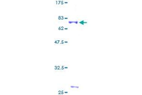 CDK9 Protein (AA 1-372) (GST tag)