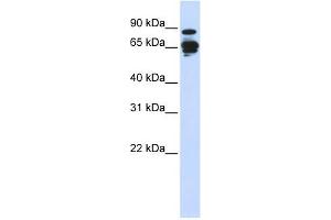 Amphiphysin antibody used at 1 ug/ml to detect target protein. (Amphiphysin antibody  (N-Term))