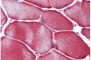 Human Skeletal Muscle: Formalin-Fixed, Paraffin-Embedded (FFPE)