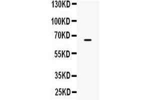 Western blot analysis of ST7 expression in PANC whole cell lysates ( Lane 1). (ST7 antibody  (Middle Region))