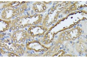 Immunohistochemistry of paraffin-embedded Rat kidney using DAPK3 Polyclonal Antibody at dilution of 1:100 (40x lens). (DAPK3 antibody)