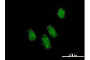 Immunofluorescence of purified MaxPab antibody to NUPL1 on HeLa cell.