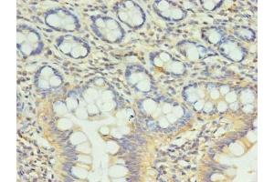 Immunohistochemistry of paraffin-embedded human small intestine tissue using ABIN7148128 at dilution of 1:100 (CCDC57 antibody  (AA 1-300))