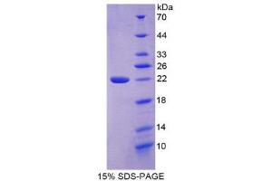 SDS-PAGE (SDS) image for Collagen, Type VI, alpha 3 (COL6a3) (AA 463-624) protein (His tag) (ABIN2124434)
