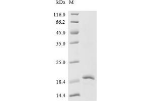 (Tris-Glycine gel) Discontinuous SDS-PAGE (reduced) with 5 % enrichment gel and 15 % separation gel.