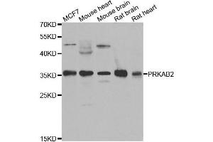 Western blot analysis of extracts of various cell lines, using PRKAB2 antibody. (PRKAB2 antibody)