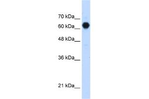 WB Suggested Anti-C3orf39 Antibody Titration:  1. (C3orf39 antibody  (Middle Region))
