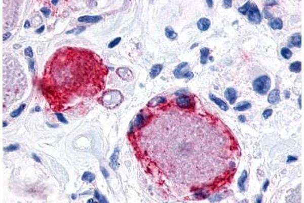 MRGPRX3 antibody  (Extracellular Domain)