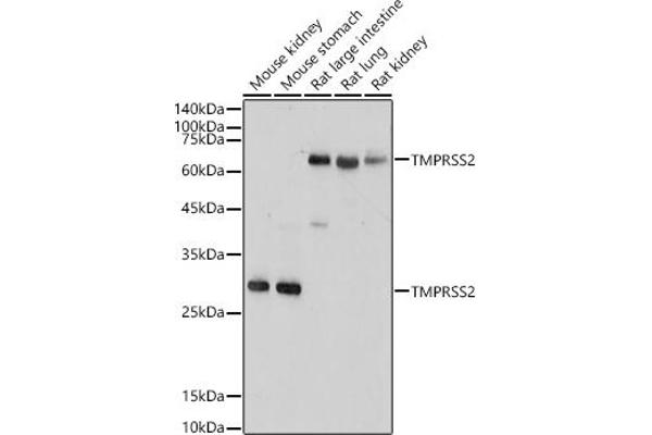 TMPRSS2 antibody  (AA 140-400)