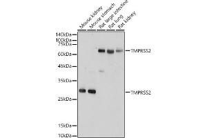 Western blot analysis of extracts of various cell lines, using TMPRSS2 antibody (ABIN6132728, ABIN6149286, ABIN6149287 and ABIN6219138) at 1:1000 dilution. (TMPRSS2 antibody  (AA 140-400))