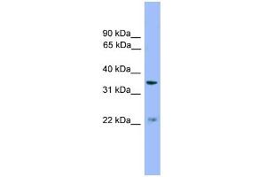 WB Suggested Anti-ZDHHC21 Antibody Titration: 0. (ZDHHC21 antibody  (Middle Region))