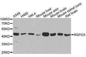 Western blot analysis of extracts of various cell lines, using RSPO3 antibody. (R-Spondin 3 antibody  (AA 1-100))