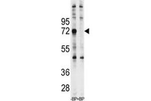 Western blot analysis of Ubiquilin-1 antibody pre-incubated with and without blocking peptide in Jurkat lysate (Ubiquilin 1 antibody  (AA 40-70))