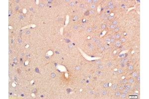 Formalin-fixed and paraffin embedded rat brain labeled with Anti-Serine Racemase Polyclonal Antibody, Unconjugated  at 1:200 followed by conjugation to the secondary antibody and DAB staining (SRR antibody  (AA 1-100))