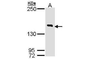 WB Image Sample (30 ug of whole cell lysate) A: Hela 7. (DIP2B antibody  (C-Term))