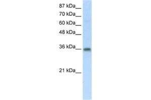 Western Blotting (WB) image for anti-Transformer 2 beta Homolog (TRA2B) antibody (ABIN2462167) (TRA2B antibody)