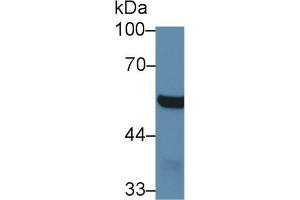Western Blot; Sample: Mouse Cerebrum lysate; Primary Ab: 1µg/ml Rabbit Anti-Mouse ABAT Antibody Second Ab: 0. (ABAT antibody  (AA 236-500))