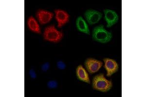 ABIN6265879 and ABIN6278541 staining Hela cells by IF/ICC. (UGT8 antibody  (Internal Region))