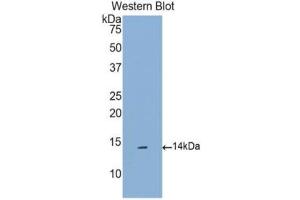 Western blot analysis of the recombinant protein. (CCL16 antibody  (AA 20-120))