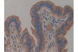 Immunohistochemistry (IHC) image for anti-Mucin 1 (MUC1) (AA 474-630) antibody (ABIN7442027)