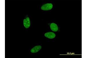 Immunofluorescence of monoclonal antibody to NR0B2 on HeLa cell.