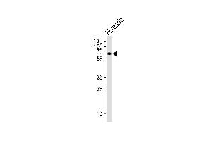 Western blot analysis of lysate from human testis tissue lysate, using ZIM2 Antibody (N-term) (ABIN6244190 and ABIN6577604). (ZIM2 antibody  (N-Term))