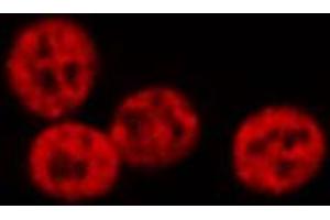 ABIN6274223 staining Hela cells by IF/ICC. (GTF2E2 antibody  (Internal Region))