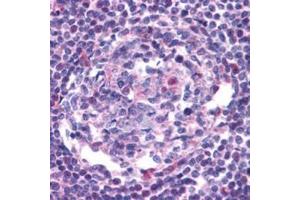 Image no. 1 for anti-Chemokine (C-C Motif) Receptor 5 (CCR5) (AA 6-20) antibody (ABIN319017) (CCR5 antibody  (AA 6-20))