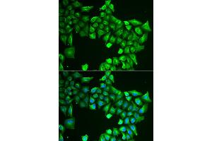 Immunofluorescence analysis of HeLa cells using ASL antibody (ABIN5973767). (ASL antibody)